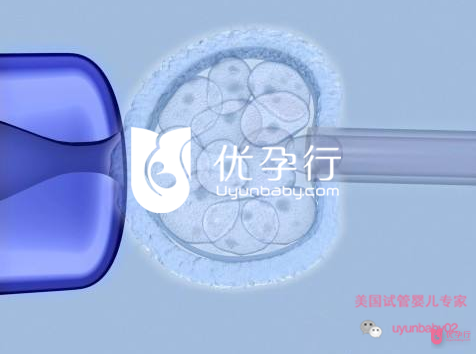 美国试管婴儿