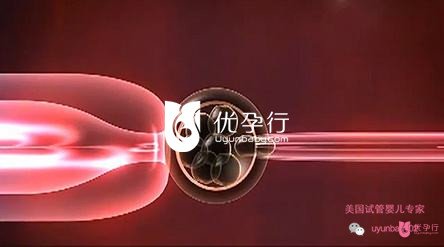 美国试管婴儿