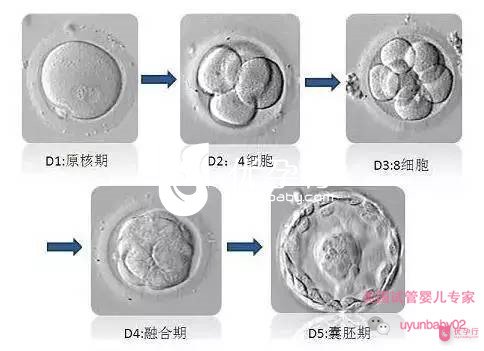 美国试管婴儿