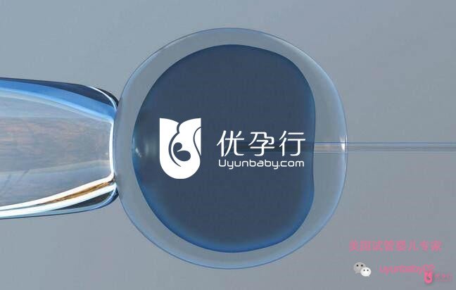 美国试管婴儿