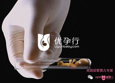 美国试管婴儿