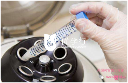 美国试管婴儿