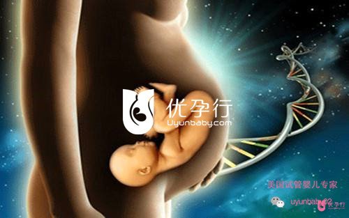 美国试管婴儿