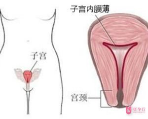 子宫内膜薄(2).jpg
