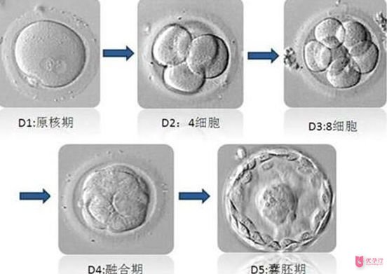 美国试管婴儿