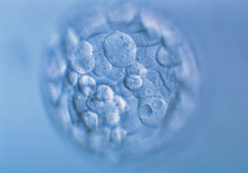 美国试管婴儿周期中多余的胚胎如何去处理