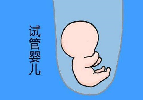 俄罗斯试管婴儿哪家好一点